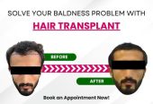 Hair care clinic in chennai