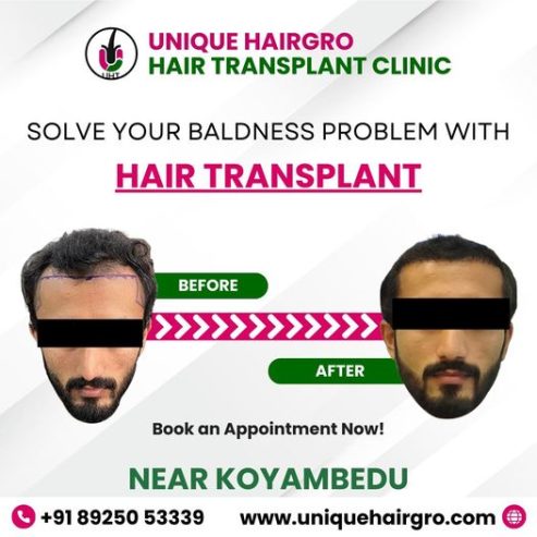 Hair care clinic in chennai