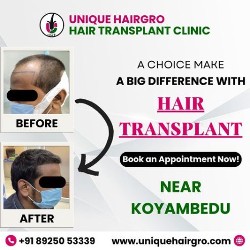 Hair care clinic in chennai