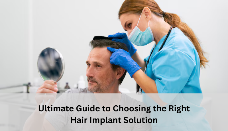 Ultimate Guide to Choosing the Right Hair Implant Solution