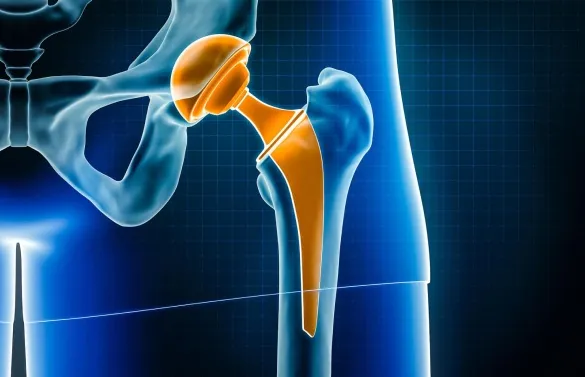 Top Knee Arthroscopy Surgeon in Jaipur | Expert Care at Partani Clinic